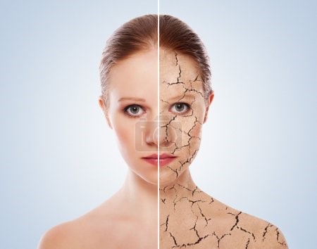 home remedies for dry skin