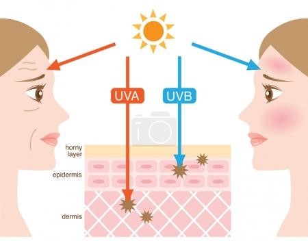 laser treatment for face side effects